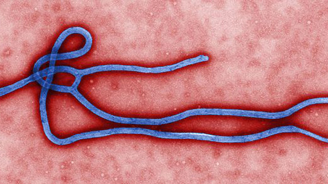 Megúszta az ebolát, hazamehet a virológus, aki fertőzött tűvel szúrta meg magát