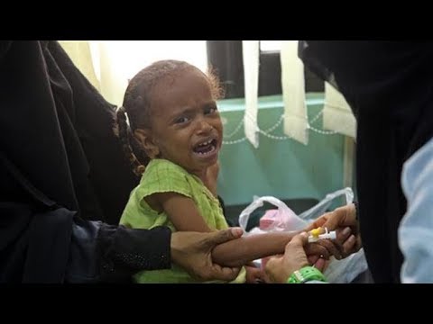 Az egyik legsúlyosabb humanitárius katasztrófa fenyeget Jemenben, milliók halhatnak éhen