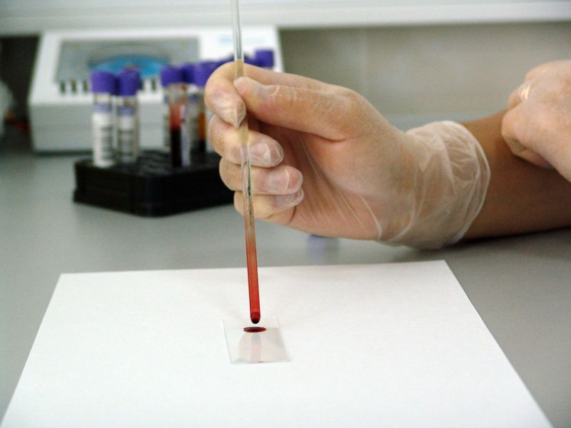 Tesztelték a rák leggyakoribb fajtáit szűrő vérvizsgálatot 