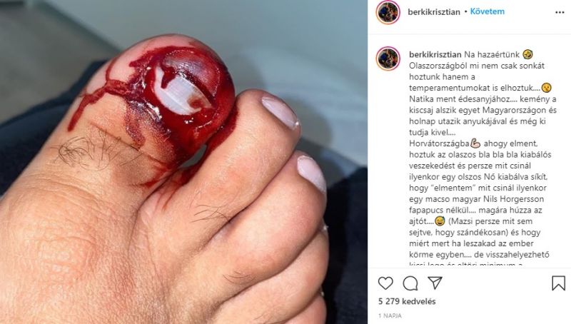 Berki Krisztián összeveszett a feleségével, majd csúnyán megsérült – 18+ fotó