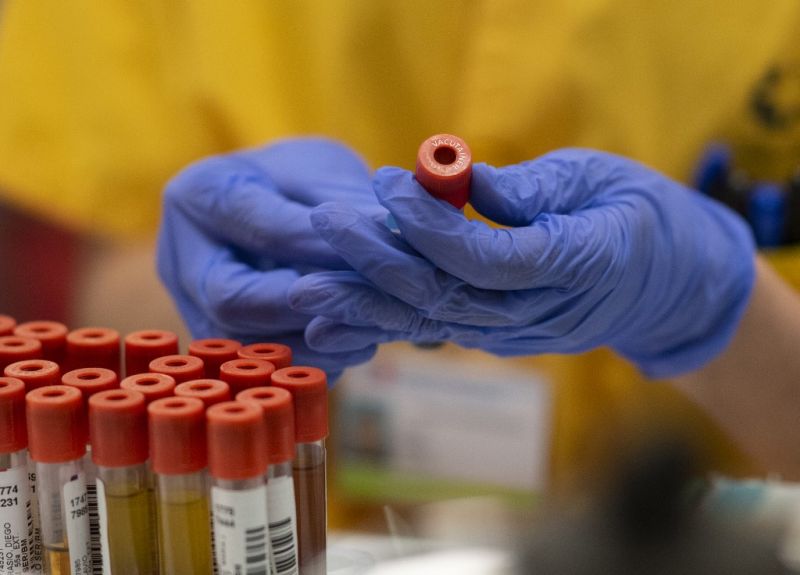 Majdnem százezer forintos koronavírus-tesztet végeznek két állami kórházban is