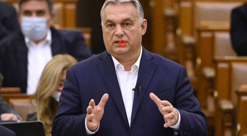 Mi történhetett, beteg lenne Orbán? – nagyon furcsa dolgot fedeztek fel a kormányfő arcán (képek)