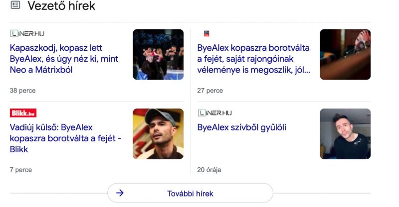 ByeAlex kopasz lett – az egész magyar sajtó lecsapott rá