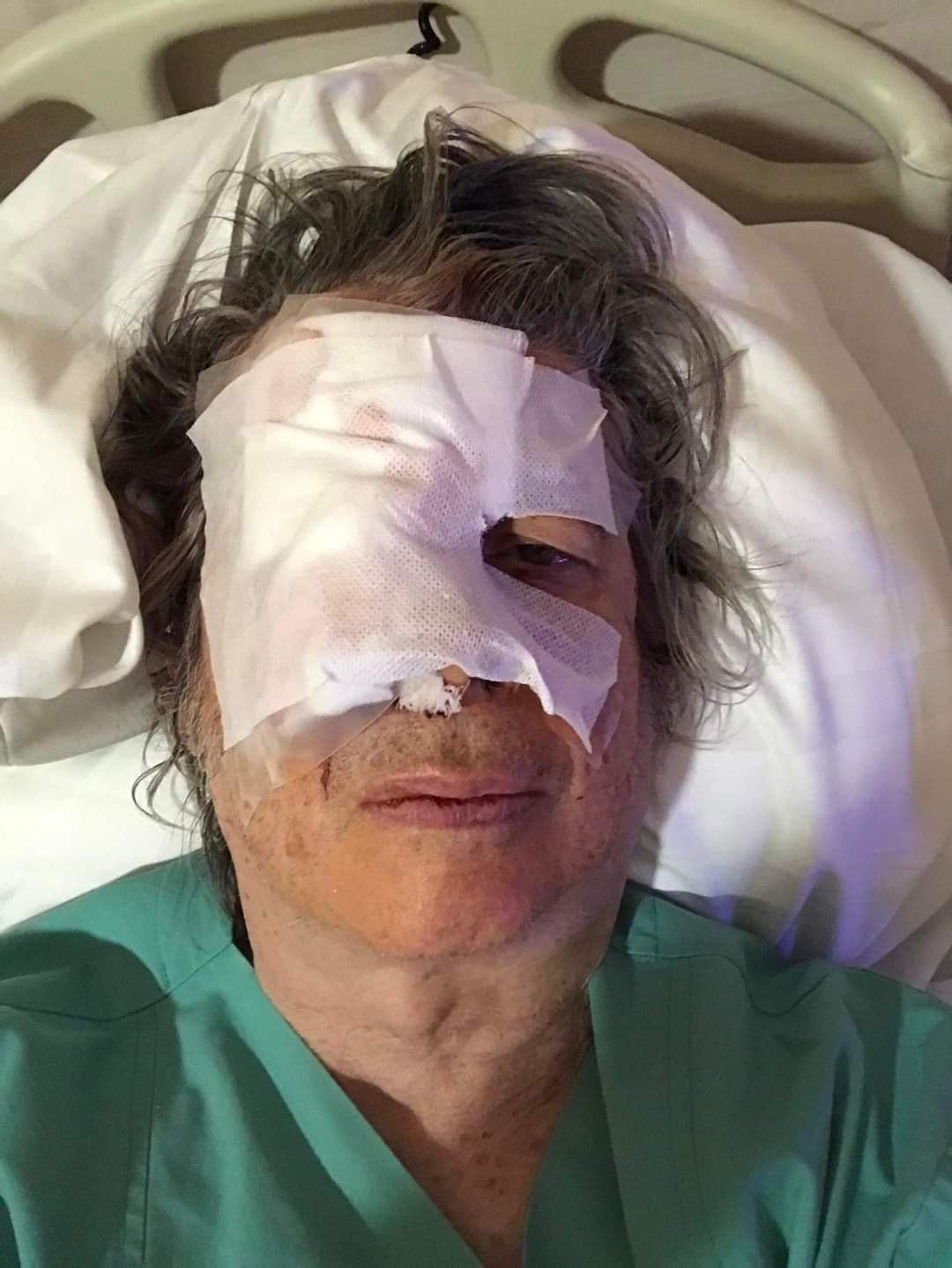 Mi történhetett Bródy János arcával? Horrorisztikus fotót osztott meg a zenészlegenda