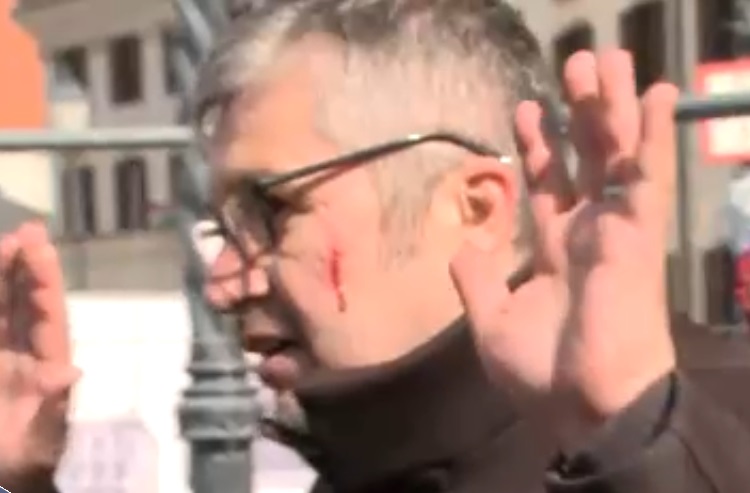 Hadházy Ákos arca megsérült, miközben a rendőrökkel dulakodott a Karmelitánál – videó